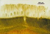 Sezione longitudinale radiale di un soro di organi uniloculari